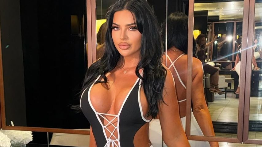 Auto-Attacke durch Rivalin? UK-Influencerin schwer verletzt