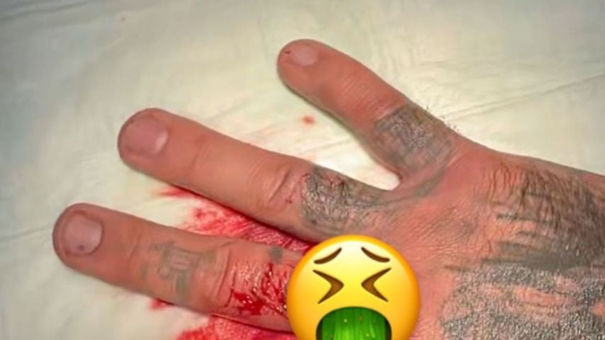 Kontra Ks Hand