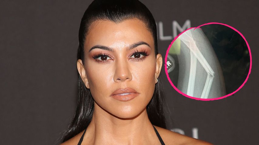 Wegen Röntgenbild: Fans besorgt um Kourtney Kardashians Baby