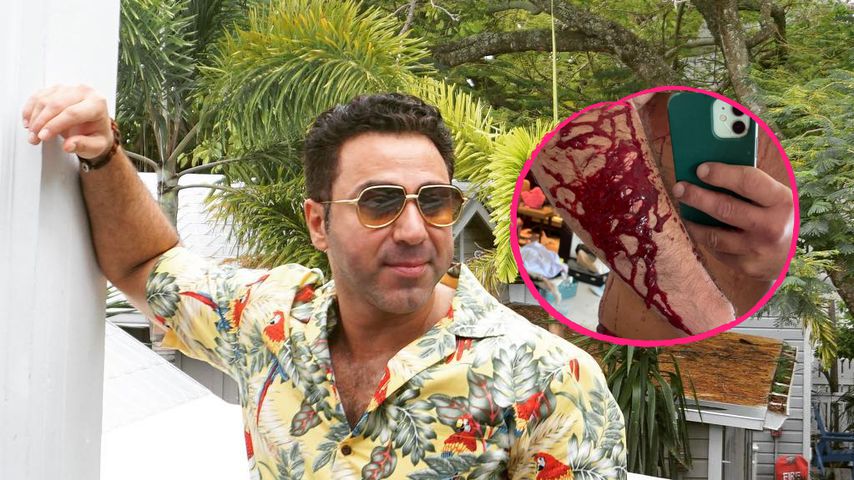 Kubilays Arm voller Blut? Was steckt hinter diesem Foto?