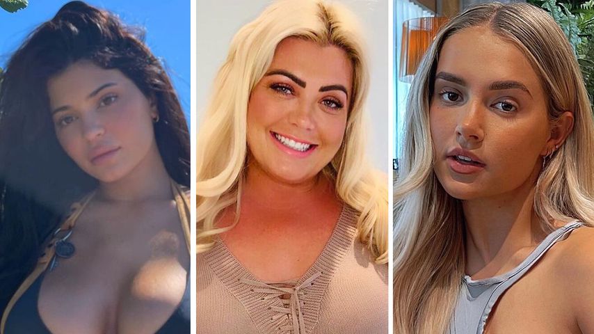 Beauty-Doc und Lipfiller ade! Stars rocken den Natural-Look
