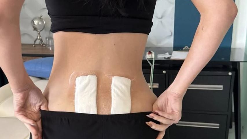 Kylie Jenner nach der Stammzellentherapie.