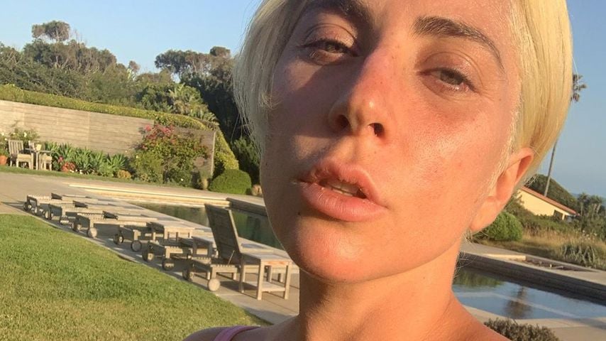 Total natürlich! Sängerin Lady Gaga zeigt sich ohne Make-up