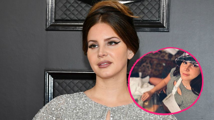 Skate-Unfall: Lana Del Rey hat sich den Arm gebrochen