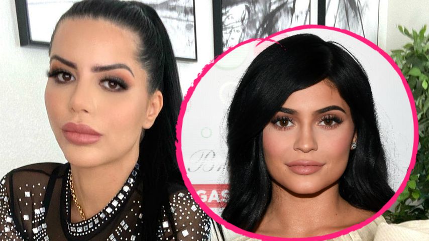 Für Kylie-Jenner-Look: TV-Star zahlte 60.000 Euro für OPs