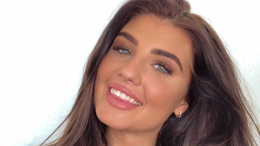 "Gerne etwas mehr": "Love Island"-Laura über Gewichtszunahme