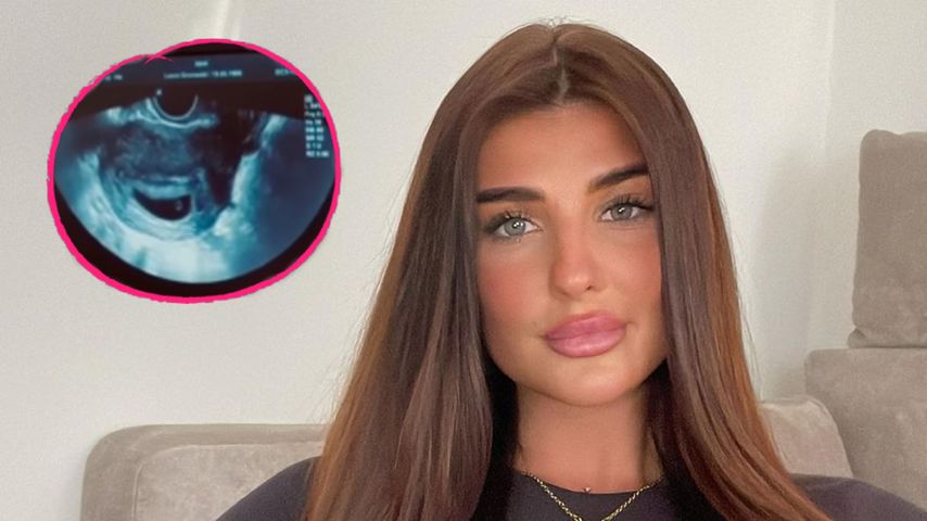 "Ex on the Beach"-Star Laura Mania erwartet ihr erstes Baby!