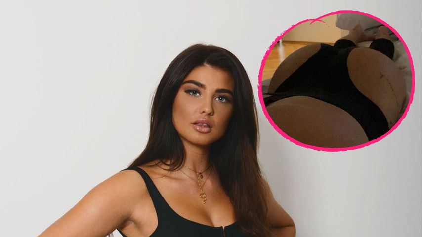 "Love Island"-Laura: So geht's ihr nach Po-Vergrößerung!