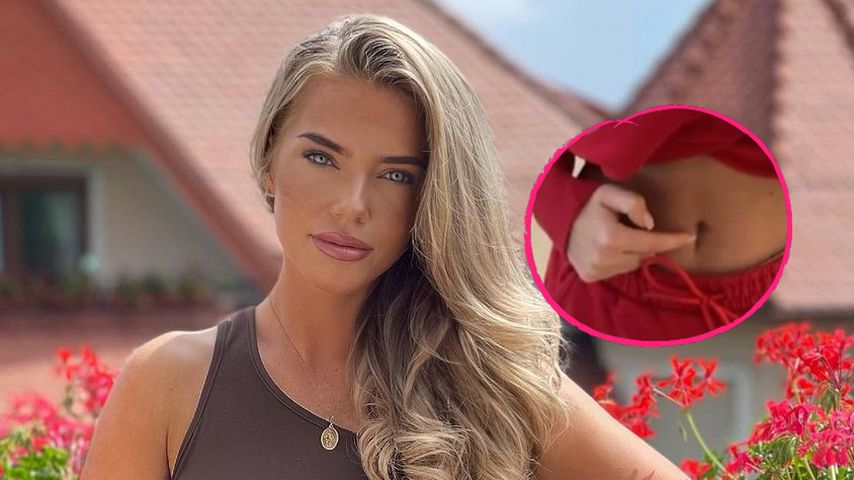 Nach Zysten-OP: Laura Maria Rypa zeigt ihre Narbe am Bauch