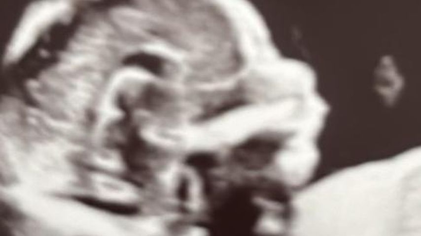 Laura Maria Rypas Baby, Ultraschallfoto