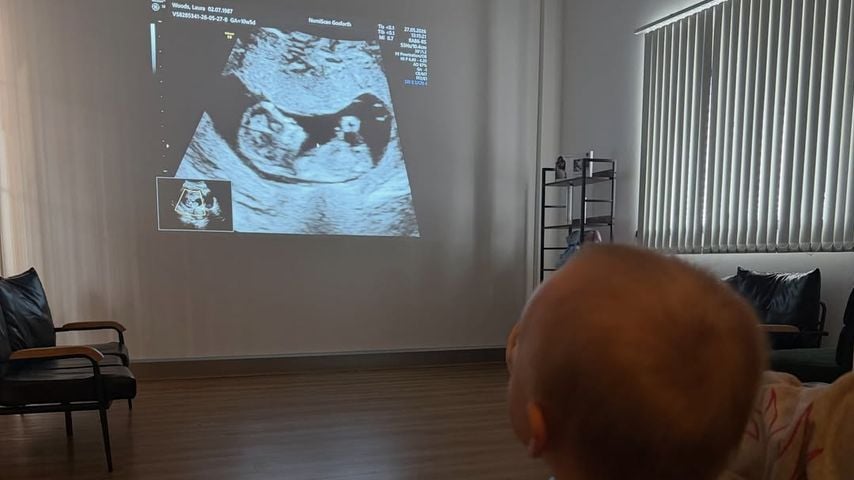 Laura Woods Kind schaut ein Ultraschallfoto an