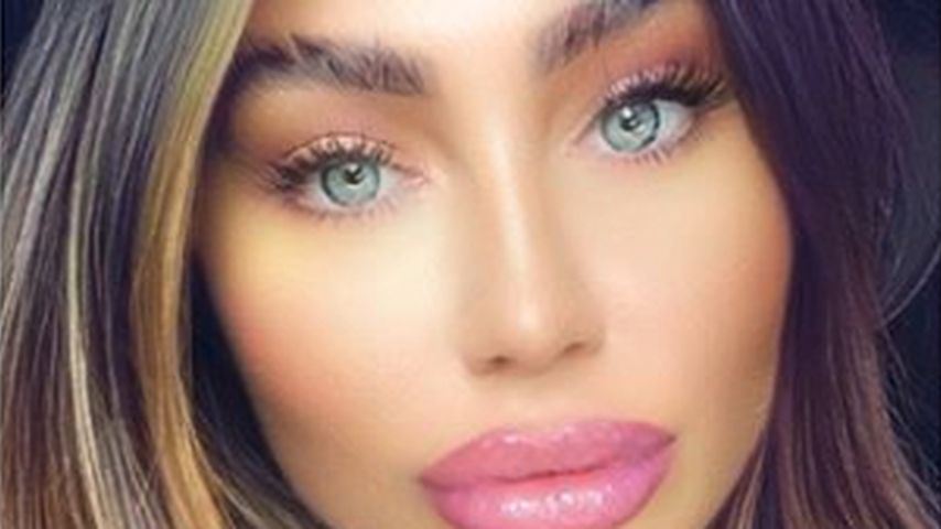 Fans flehen: Lauren Goodger soll mit Lipfillern aufhören