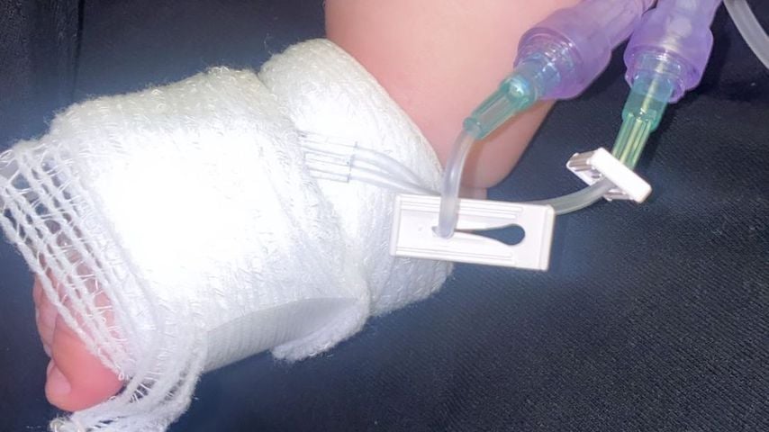 Fuß von Lauren Goodgers Tochter im Krankenhaus