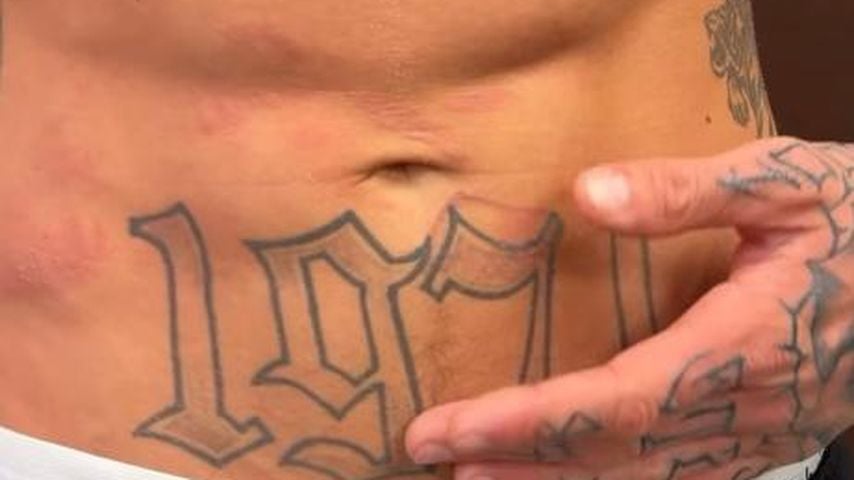 Laurenz Peschs Verbrennungen nach dem Stunt, Januar 2026