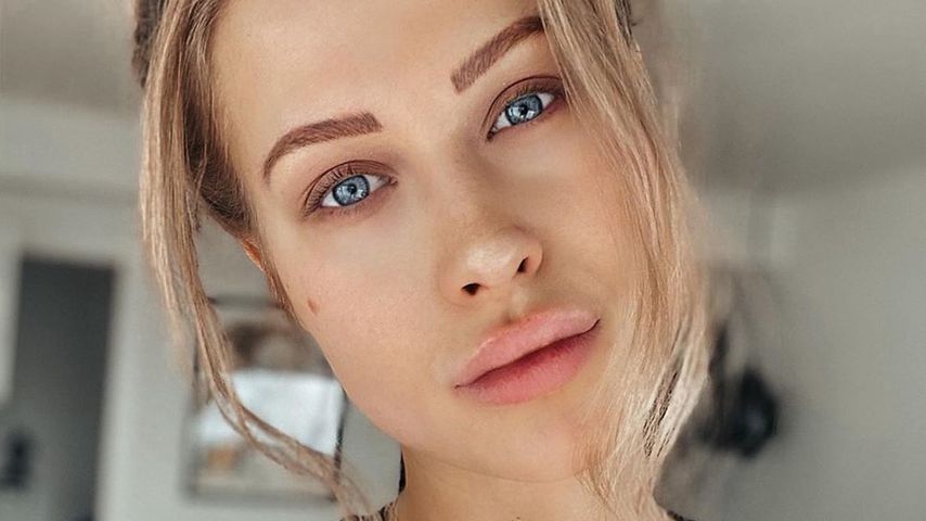 Heftige Botox-Unterstellungen: Das sagt Bachelor-Girl Leah
