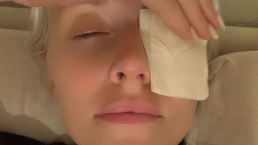 Oje! Lena Gercke verletzt sich Auge bei "Haushaltsunfall"
