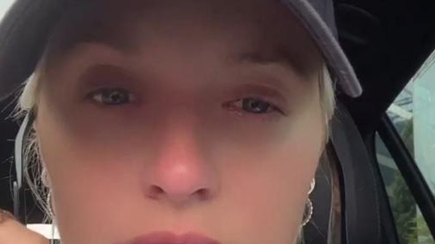 Lena Gercke zeigt ihr verletztes Auge