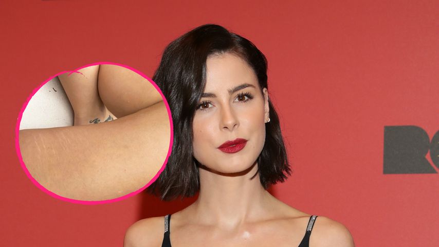 "Team Body Love": Lena Meyer-Landrut zeigt Dehnungsstreifen