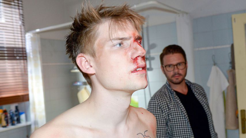 Heftige Bilder: GZSZ-Moritz wurde von Homophoben verprügelt!