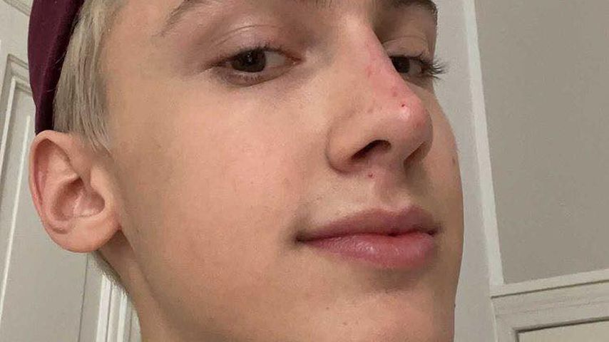 Leon Content, nach einem Beauty-Eingriff