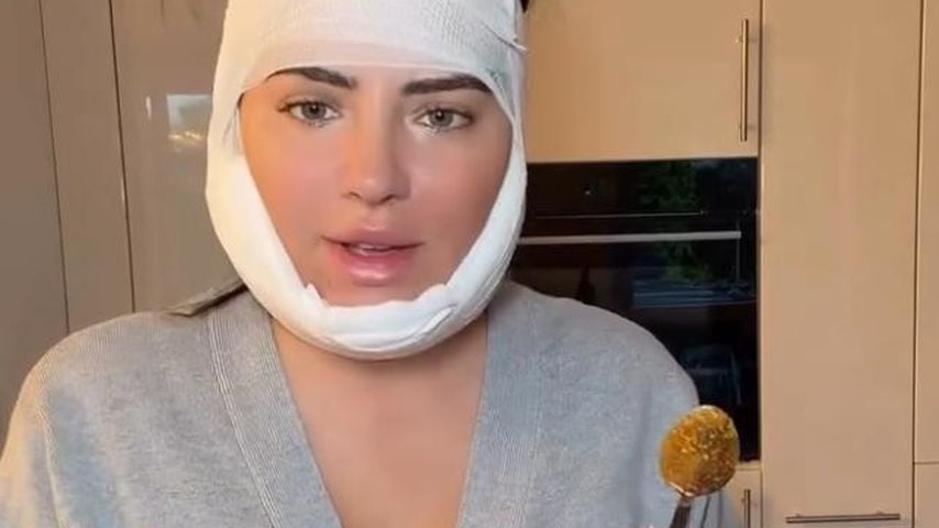 Vorbild? Leyla Heiter wird nach Beauty-OP heftig kritisiert