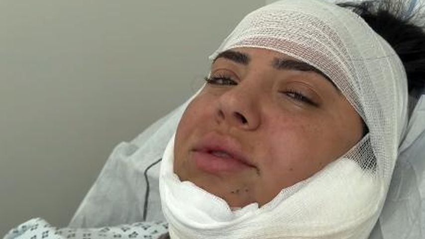 Fett gespritzt: Leyla Heiter ließ sich Doppelkinn absaugen