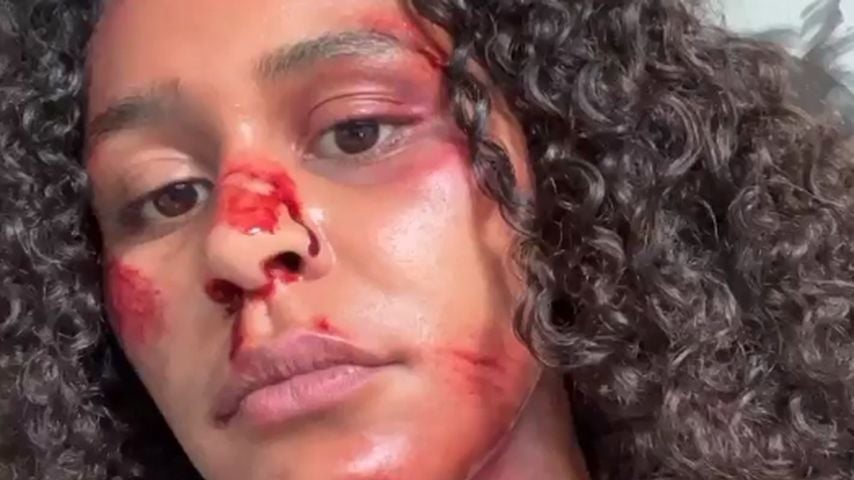 Was ist passiert? GNTM-Lijanas Gesicht ist blutüberströmt