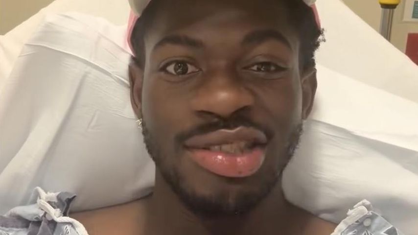 So steht es um Lil Nas X nach plötzlicher Gesichtslähmung