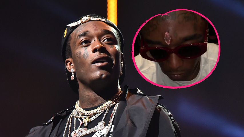 Rapper Lil Uzi Vert ließ sich rosa Diamant in Kopf piercen!