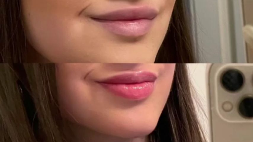 Lisa Marie Straubes Lippen nach der Lippenpigmentierung