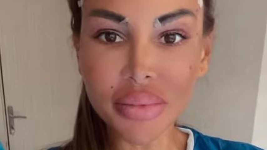 XXL-Lippen ade: Lisha Savage will zurück zur Natürlichkeit