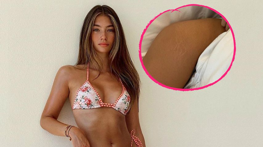 Model Lorena schämt sich nicht für ihre Dehnungsstreifen