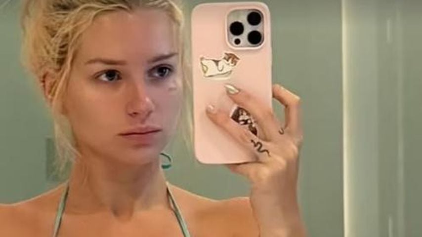 Keine Filler mehr: Lottie Moss zeigt neue Natürlichkeit