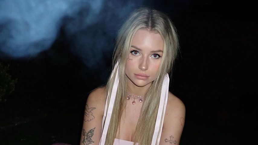 Filler-Entfernung: Lottie Moss kann Gesicht nicht bewegen!