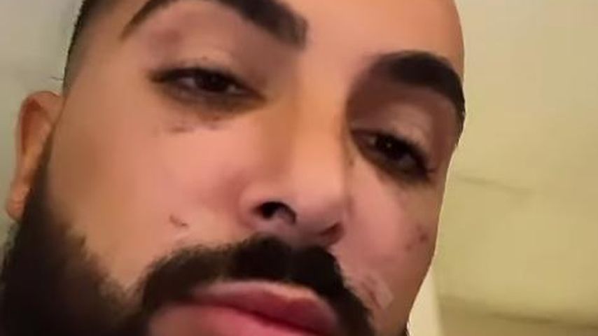 Lou im September 2023 beim Beauty-Doc