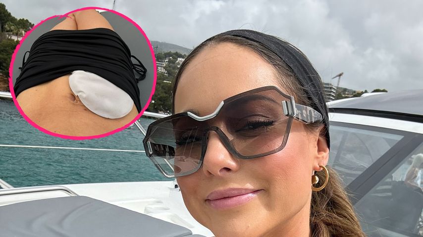 Mit Stomabeutel: Louise Thompson posiert stolz im Bikini!
