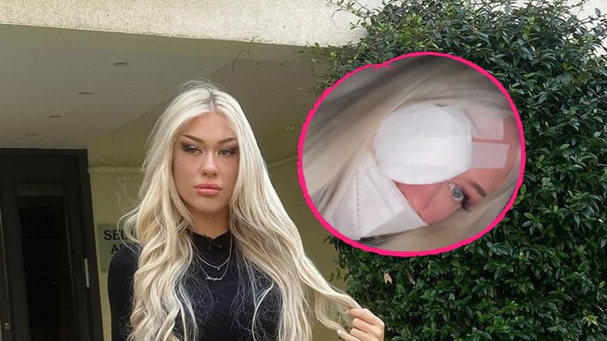 Lockenstab: "Temptation Island"-Luisa verbrennt sich im Auge