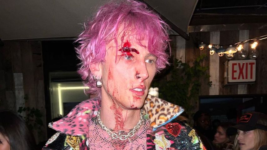 Machine Gun Kelly klärt auf: Darum hatte er eine Platzwunde