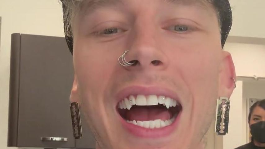 Fans sind begeisert: Machine Gun Kelly trägt jetzt Reißzähne