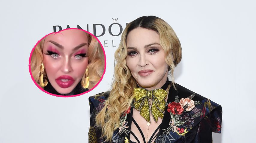 Megagruselig: Hier wirkt Madonnas Gesicht total entstellt