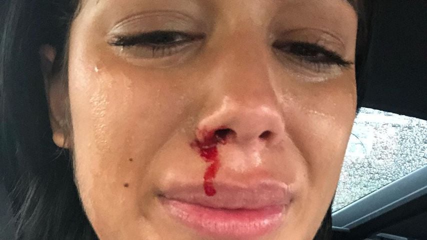 Hausarrest statt Gefängnis für Malin Anderssons brutalen Ex