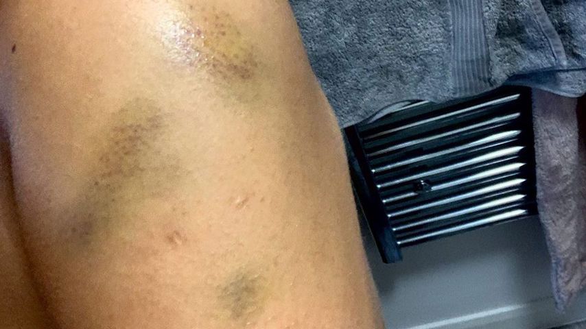 Malin Anderssons Arm