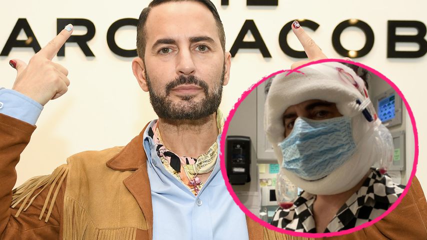 Dicke Gesichtsbandagen: Marc Jacobs gönnte sich Facelifting