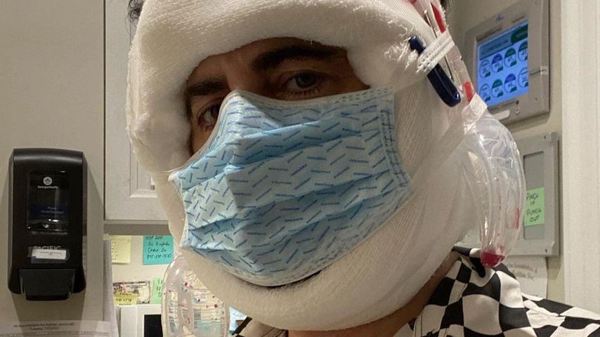 Marc Jacobs nach seinem Facelifting, Juli 2021