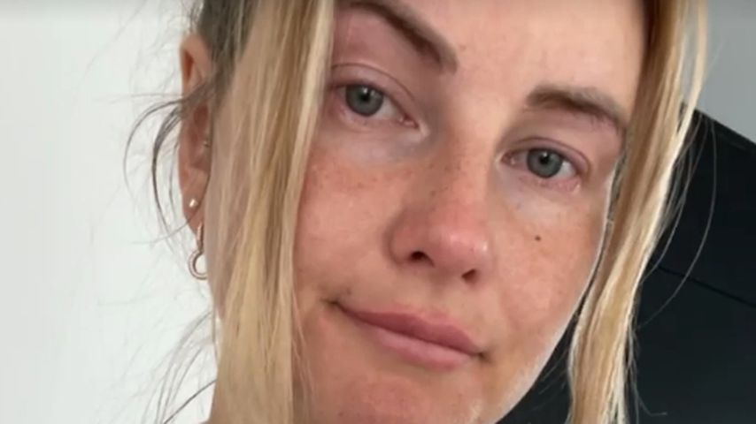 Diagnose Lipödem: Maren Wolf gibt beunruhigendes Update