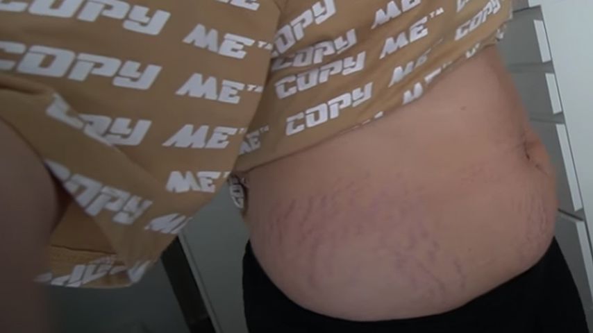 Maren Wolfs After-Baby-Body