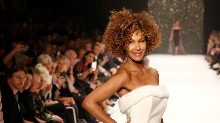 Zu viel Stress: Model Marie Amière hatte starken Haarausfall