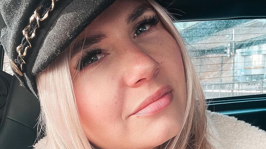 So schmerzhaft war "Temptation Island"-Marlisas Gesichts-OP!