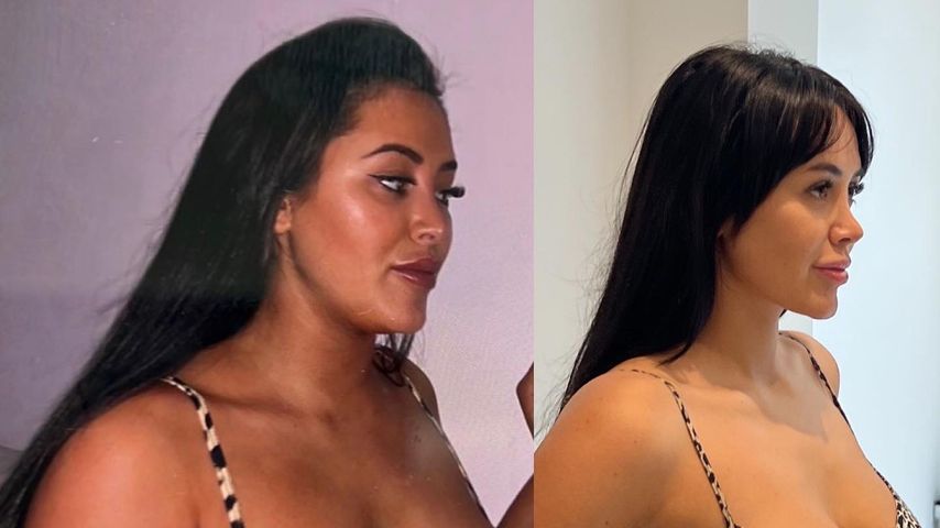 12 Kilo weniger: Marnie Simpson teilt Vorher-Nachher-Collage