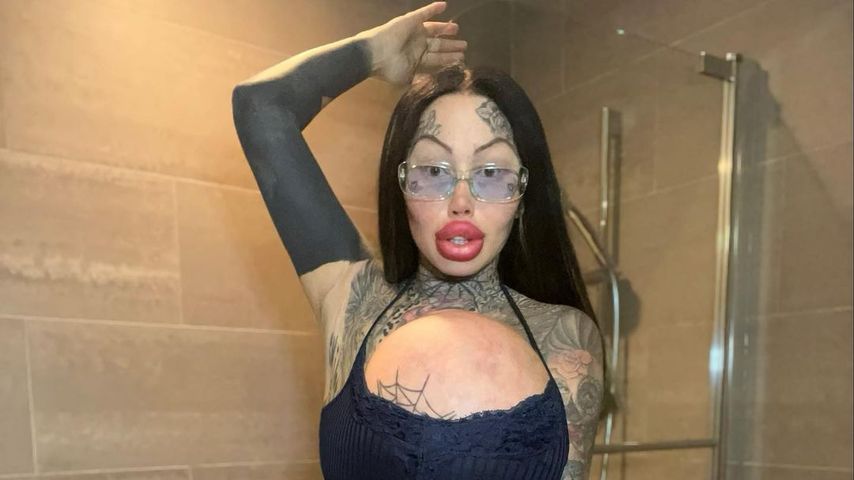 XXL-Brüste geplatzt: Mary Magdalene will natürlicher werden